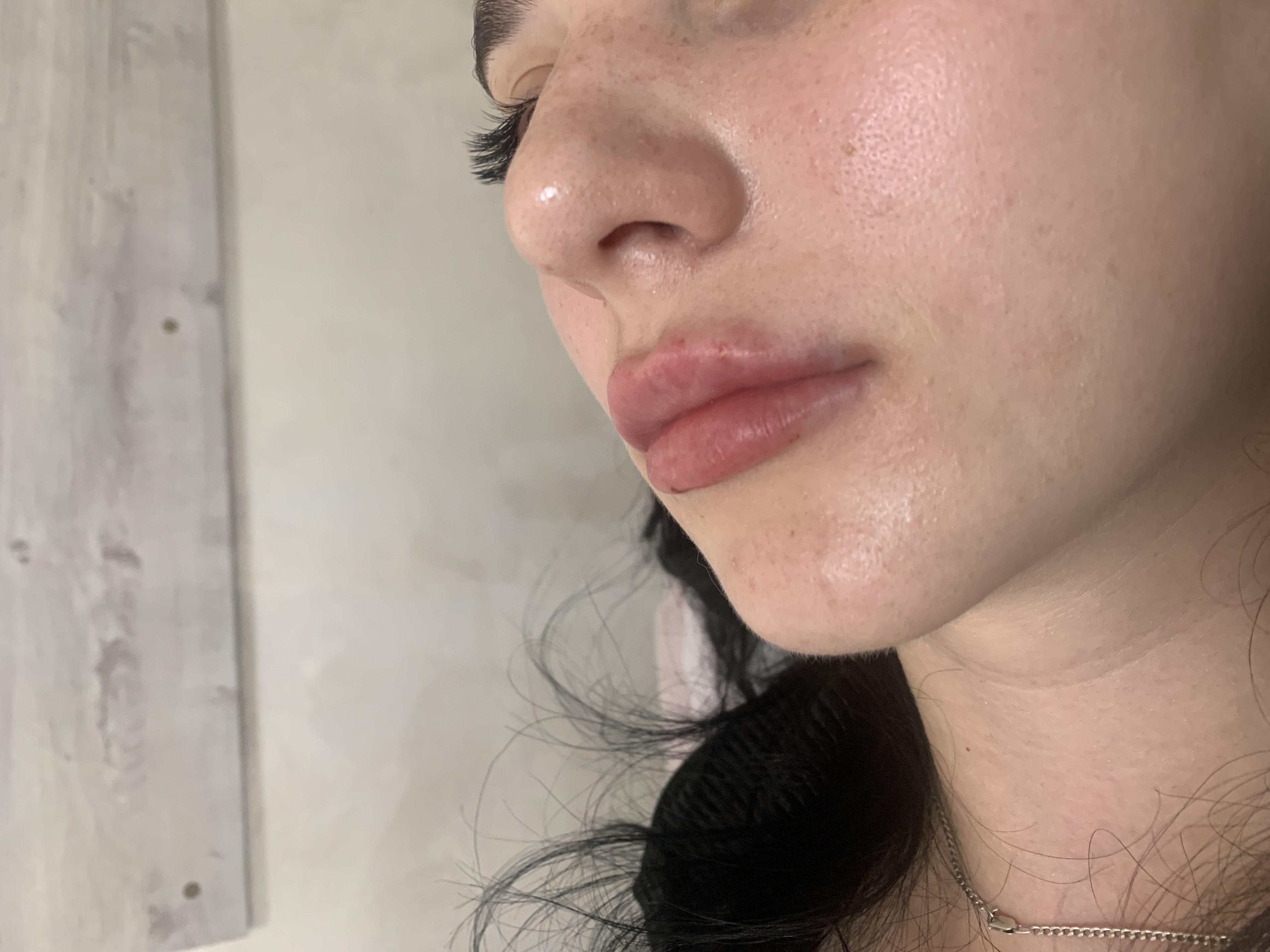 Контурна пластика губ 60 хв