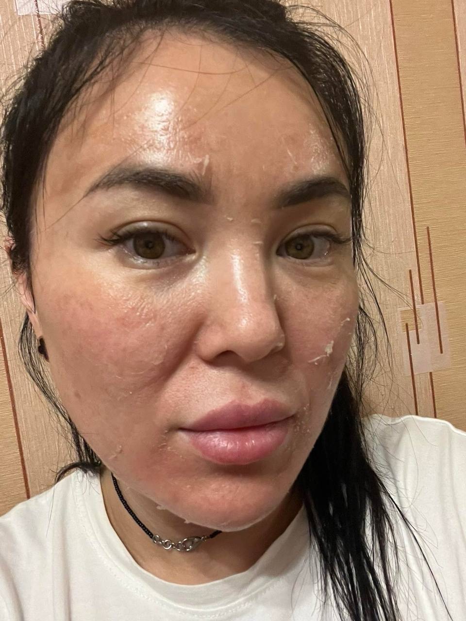 Пілінг резорциноловий Anubis